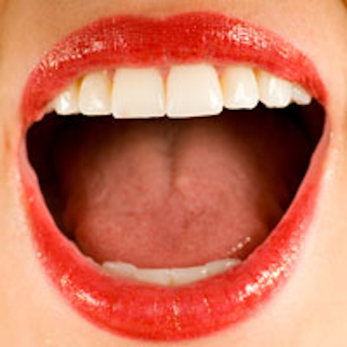 Open-Mouth-200