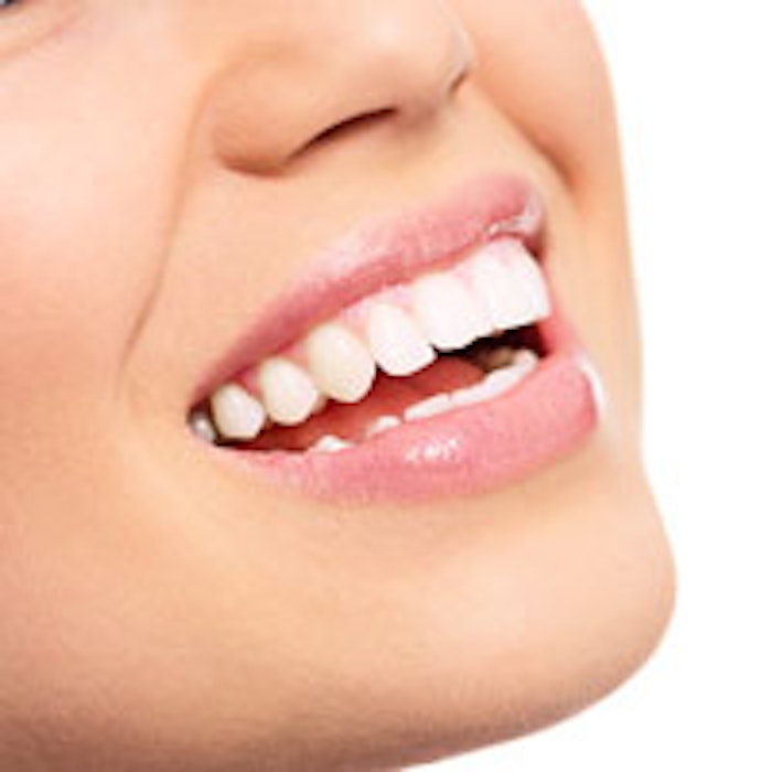 Fresh-white-teeth-200