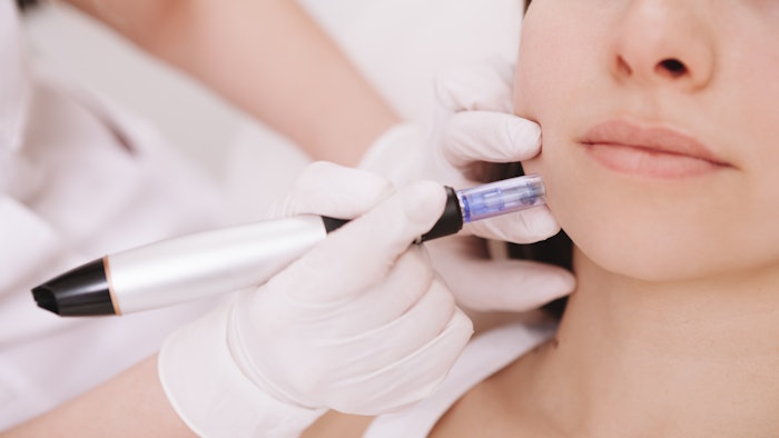 Research indicates that microinjections of hyaluronic acid and glycerol can statistically improve skin firmness, fatigue and density.