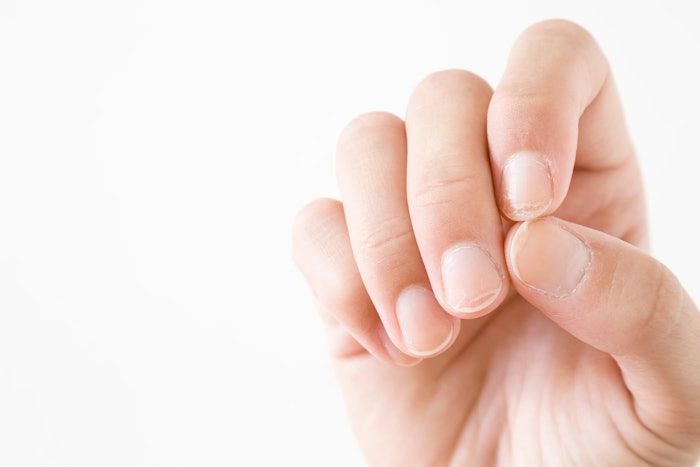 Natasha Parikh and Heather Reynosa from OPI share what kind of TLC will help damaged nails.