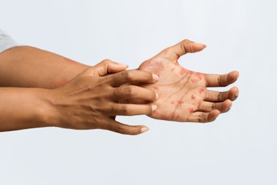 Adobe Stock 317044154