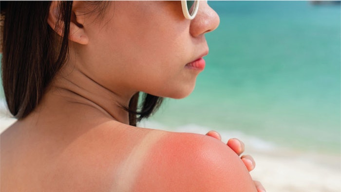 Summer Sun Damage Protocols