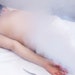 Trend Watch: Cryotherapy
