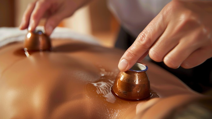 Close-up of a therapist performing a cupping therapy session on a patient, applying cups to the patient's back, soothing clinic background, Portrait close-up, hyper-realistic, high detail,