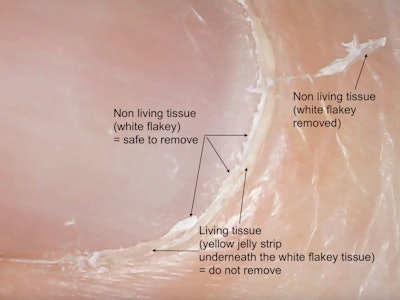 What To Remove During Cuticle Prep