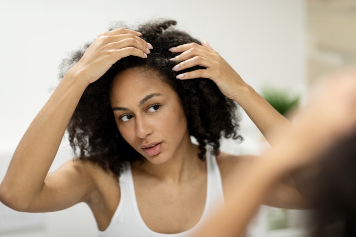 Derived via green fractionation from Moroccan saffron petals (Crocus sativus L.), DandErase reduces inflammation and erythema, mitigates itching and scalp discomfort, restores the barrier function of the skin and scalp, and balances the microbiome for long-lasting anti-dandruff effects.