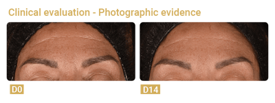 Allured Peptid4® B Like Graphic Element