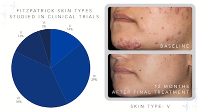 Med Esthetics Sponsored Content Chart