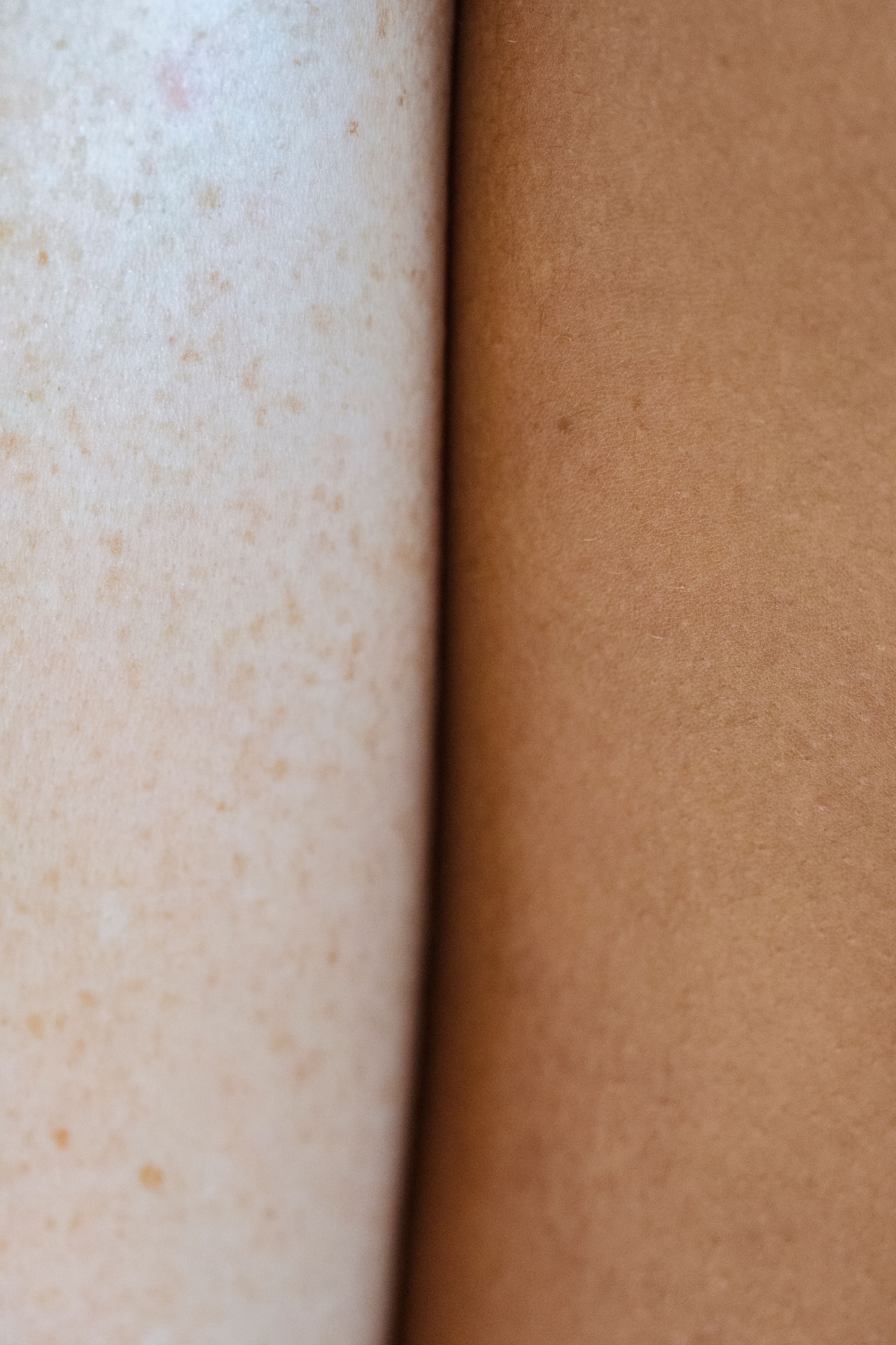 Close-up comparison of two different skin tones side by side showing diversity