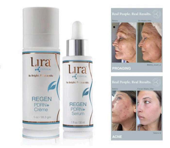 Lura skincare products with before-and-after results showing proaging and acne treatment benefits