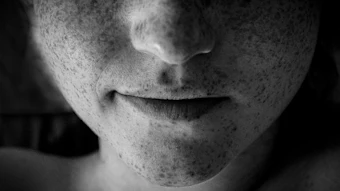 Close-up black and white portrait of lower face showing chin and mouth with freckles
